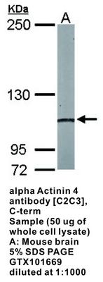 alpha Actinin 4 antibody [C2C3], C-term, GeneTex