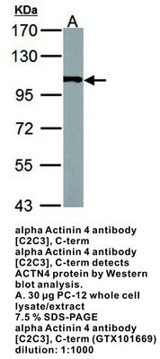 alpha Actinin 4 antibody [C2C3], C-term, GeneTex