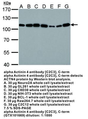 alpha Actinin 4 antibody [C2C3], C-term, GeneTex