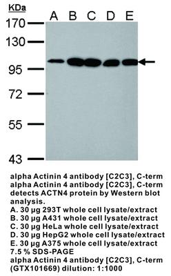 alpha Actinin 4 antibody [C2C3], C-term, GeneTex