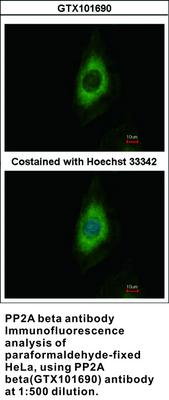 PP2A beta antibody, GeneTex