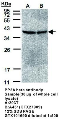 PP2A beta antibody, GeneTex