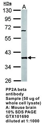 PP2A beta antibody, GeneTex