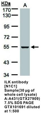 ILK antibody [N1C1], GeneTex