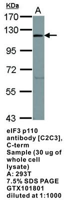 RB PAB TO EIF3 P110