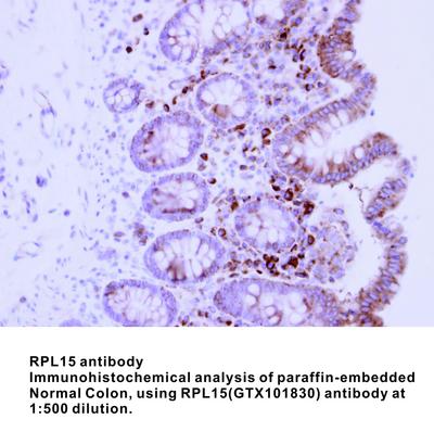 RPL15 antibody, GeneTex