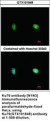 Ku70 antibody [N1N3], GeneTex