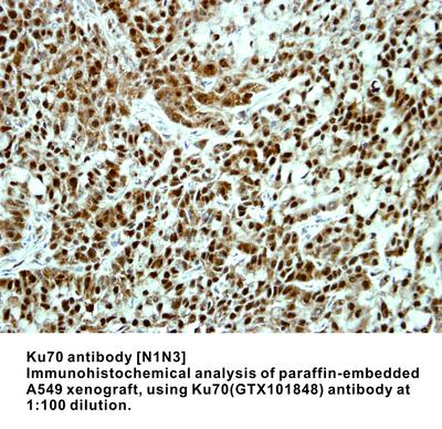 Ku70 antibody [N1N3], GeneTex