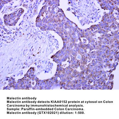 Malectin antibody [N3C3], GeneTex