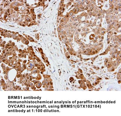 BRMS1 antibody, GeneTex