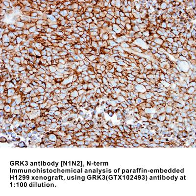 GRK3 antibody [N1N2], N-term, GeneTex