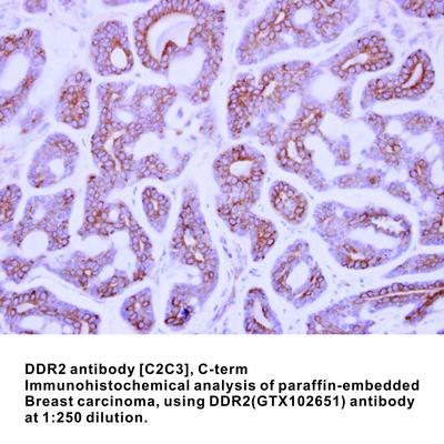 DDR2 antibody [C2C3], C-term, GeneTex