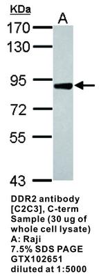 DDR2 antibody [C2C3], C-term, GeneTex