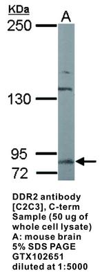 DDR2 antibody [C2C3], C-term, GeneTex