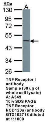 TNF Receptor I antibody, GeneTex