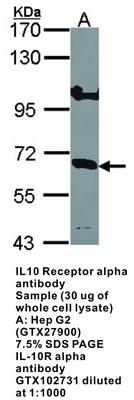 RB PAB TO IL10 RECEPTOR ALPHA