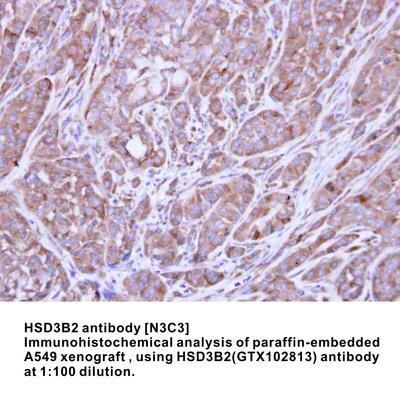 HSD3B2 antibody [N3C3], GeneTex