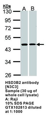 HSD3B2 antibody [N3C3], GeneTex