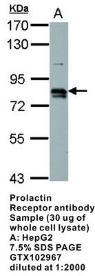 RB PAB TO PROLACTIN RECEPTOR