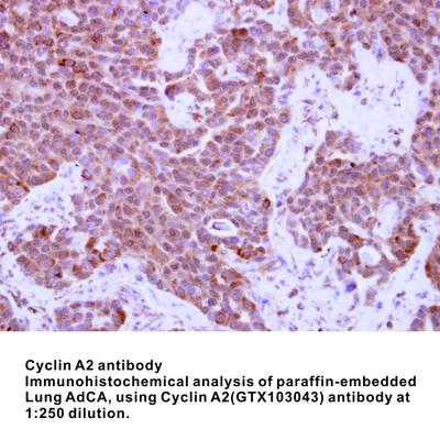 Cyclin A2 antibody - Rabbit Polyclonal - IHC-P, WB, GeneTex