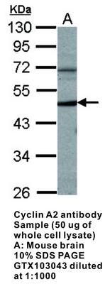 Cyclin A2 antibody - Rabbit Polyclonal - IHC-P, WB, GeneTex