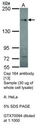 Cep 164 antibody [13], GeneTex