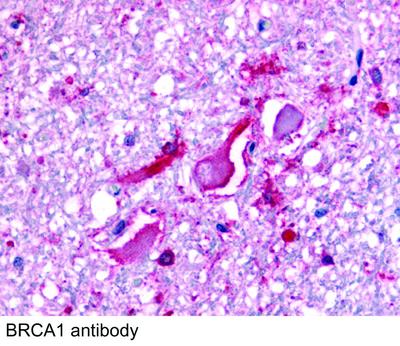 BRCA1 antibody - 50µl, GeneTex