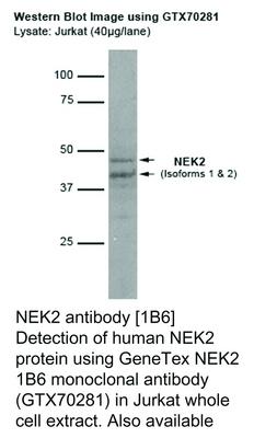 NEK2 antibody [1B6], GeneTex