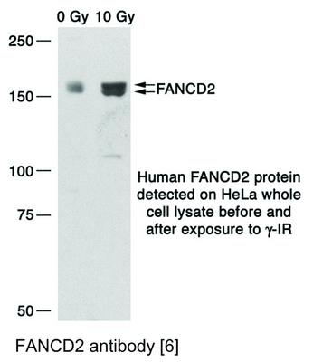 FANCD2 antibody [6], GeneTex