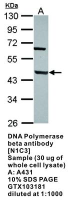 RB PAB TO DNA POLYMERASE BETA