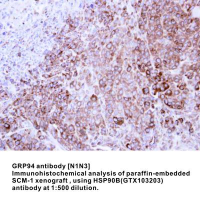 GRP94 antibody [N1N3], GeneTex