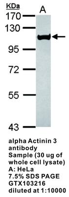 RB PAB TO ALPHA ACTININ 3
