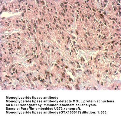 Monoglyceride lipase antibody [N1C3], GeneTex