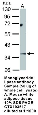 Monoglyceride lipase antibody [N1C3], GeneTex