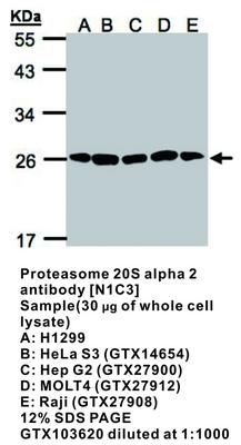 RB PAB TO PROTEASOME 20S A 2