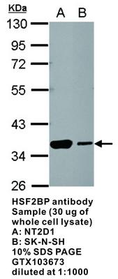 RB PAB TO HSF2BP