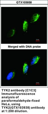 TYK2 antibody [C1C3], GeneTex