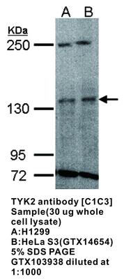 TYK2 antibody [C1C3], GeneTex