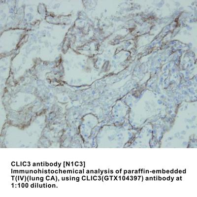 CLIC3 antibody [N1C3], GeneTex