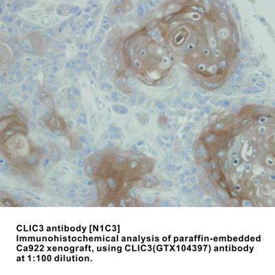 CLIC3 antibody [N1C3], GeneTex