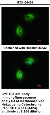 Cytochrome P450 1B1 antibody [N3C3], GeneTex