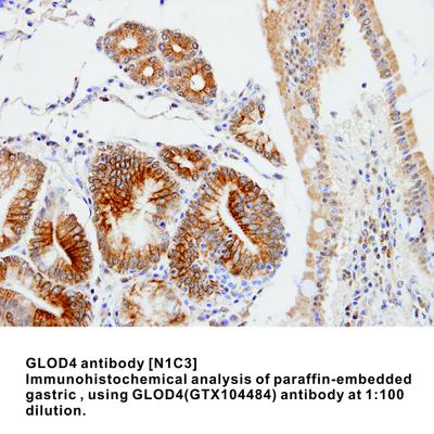 GLOD4 antibody [N1C3], GeneTex