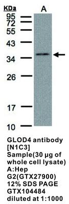 GLOD4 antibody [N1C3], GeneTex