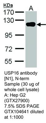 RB PAB TO USP16