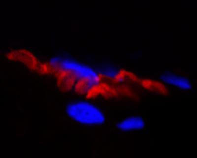 Bungarotoxins and Fluorescent Bungarotoxin Conjugates, Biotium