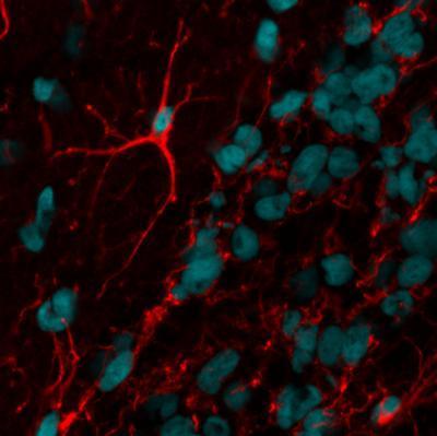 CF™594 Secondary Antibody Conjugates, Biotium