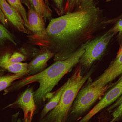 CET Human Bone Marrow Mesenchymal Stem Cells, Thermo Scientific