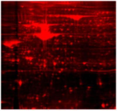 Lumitein™ Protein Gel Stain