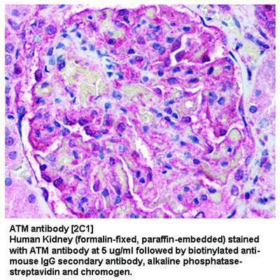 ATM antibody [2C1], GeneTex