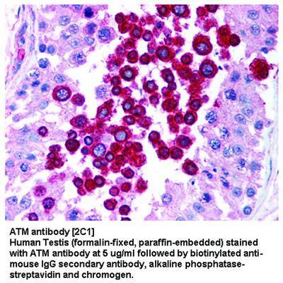 ATM antibody [2C1], GeneTex